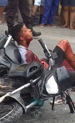 Uhh... You Got Something in Your Neck