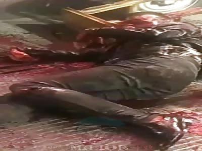 Man brutally attacked with machete