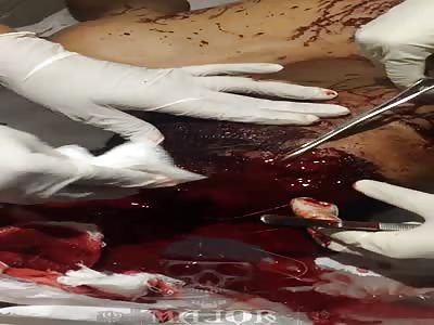 man has knife stuck in his head