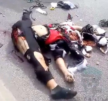 Woman's Vagina Ripped WIDE Open after BRUTAL accident