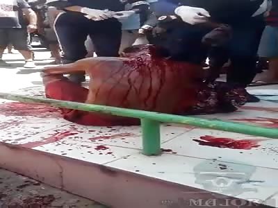 banned struck by machete