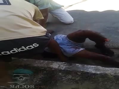 man with broken leg in accident