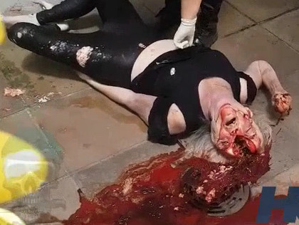 Suicide Woman Jump from Building and Brains Ejecting Aftermath