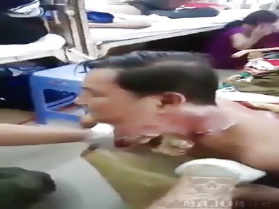 man with terrible cancer in neck