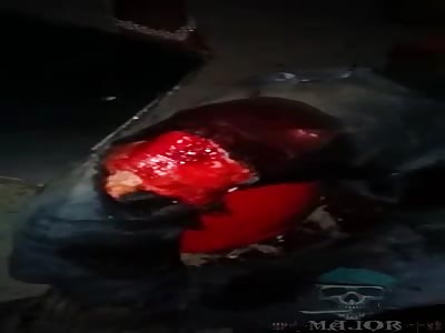 man with broken leg in accident