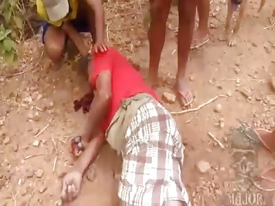 man agonizing in a motorcycle accident