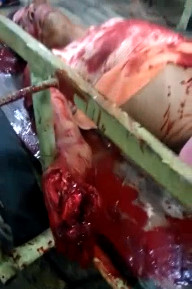 Never Put Your Hands On A Machete