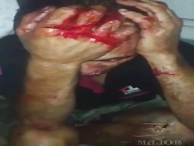 thief punished in favela in Brazil