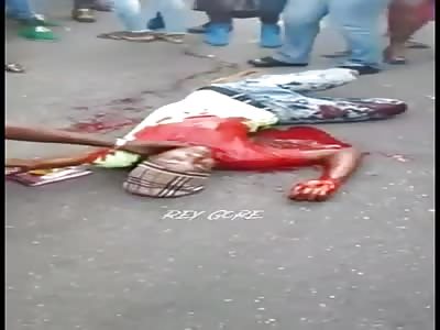 Stabbed, in agony after fight 