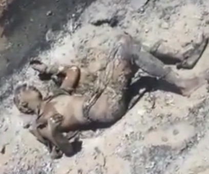 At Least He's Not Burned to Crisp