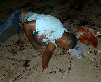 Bandits Cut Off Rivals' Hand and Finger