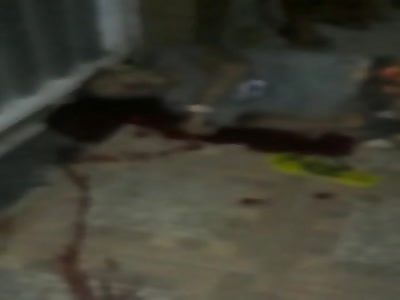 victim of shots in street