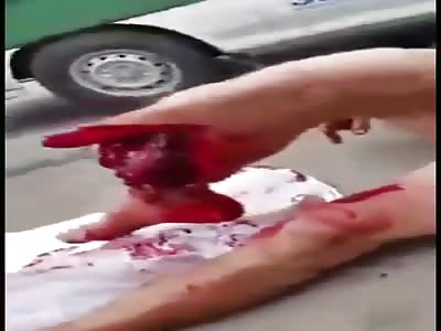 accident with young boy 