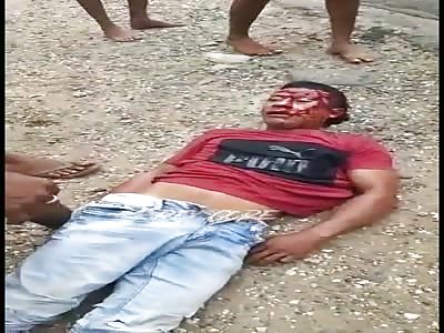 Injuried after accident 