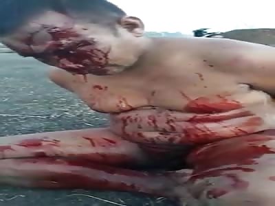 The Mess After a Machete Attack