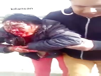 shocking accident with woman 