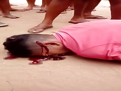 Agony to death, man get shots in head