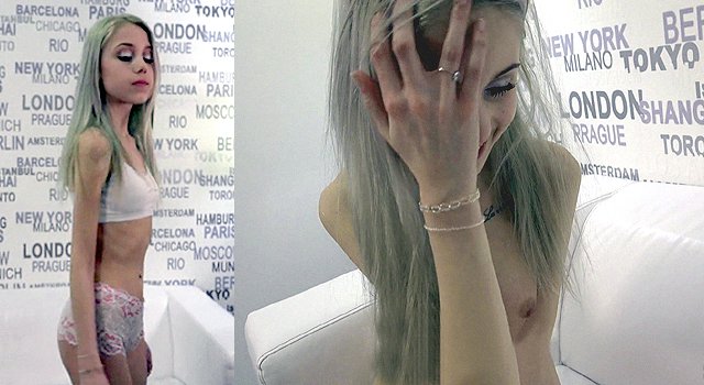 Anorexic Girl Loses Virginity at Photoshoot