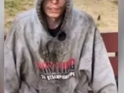 Addict Shows his Body Scars from Needles (HORRIFIC)