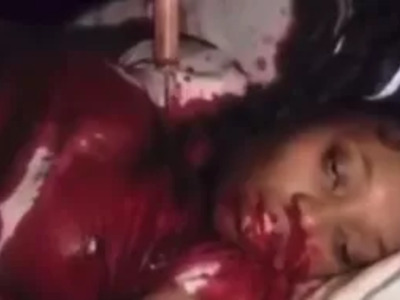 She Loses Knife-Fight with her Boyfriend.