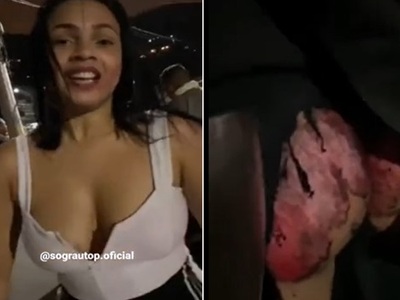 Pretty Girl has Road-Rash on her Ass... Lol