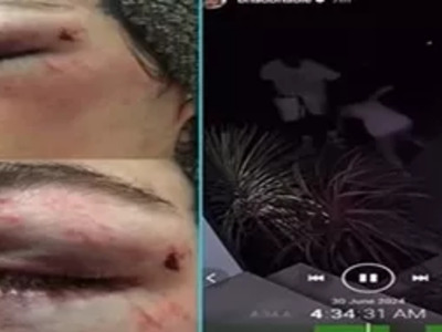 'Cash me Outside' Chick Beaten by her Baby Daddy