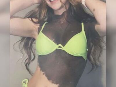 Birthmark Beauty... Smash or Pass?