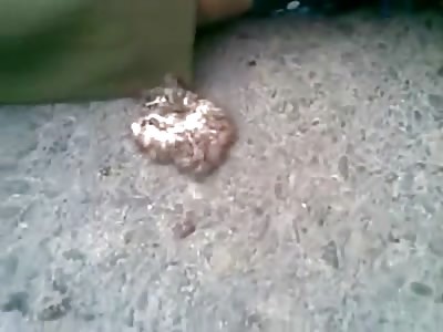 Human Head Cracked on the Pavement Like an Egg ... Blood Everywhere