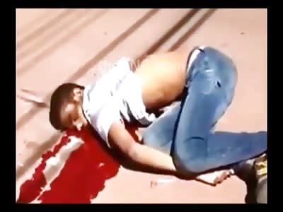 Man in Total Agony Bleeding and Dying in the Street after Being Shot in the Head