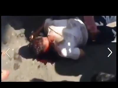 Dont Cause an Accident in this Part of Town..Man takes his Final Gasps as he's Bleeding to Death in the Road 