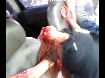 Woman Dying in the Front Seat as Her Husband Hugs Her in Desperation 