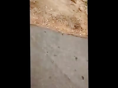 Mans Torn Off Leg Matches his Shirt