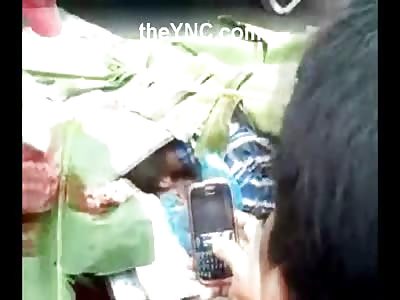 Scooping Up His Brains with Your Hands isn't a Job For Most People