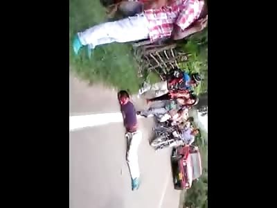 Man in total Agony When his face is Nearly Ripped off From a Guard Rail