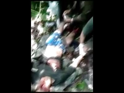 Colombian Soldier Feet Blown Off by Land Mine....