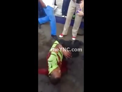 New Video of Man who left His Arm Sitting on the Hood of a Car, Watch till the End when a Man Picks it Up 