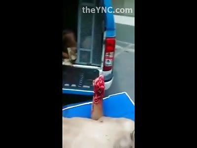 Never Mind That...Thug Arrives at Police Station with Hacked Off Hand...No One Cares..