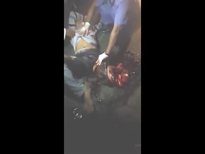 Man in Complete and Total Agony with His Leg Ripped Off