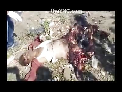 Wow...Man with His Legs Completely Shredded Off is Still Alive as People try to Help Him 