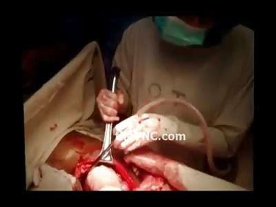 Crazy Video of Man with Iron Rod Through and Through his Torso