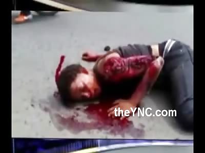 Poor Kids Arm is Ripped THE FUCK Up..... Squirms in Agony