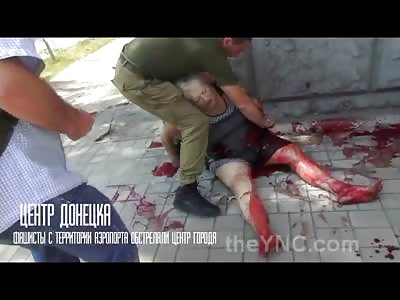 Elderly Woman's Arm Torn up after Bombing at Public Store