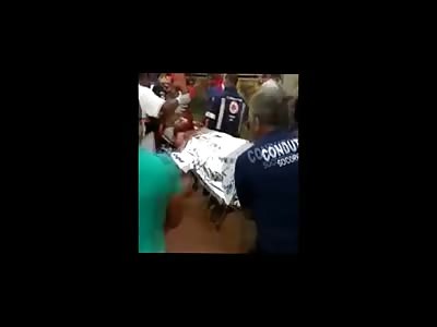 Horrible Work Accident ... Man with Wood Stuck Through his Neck and Chest