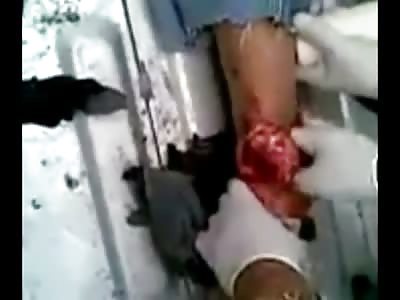 Man in Horrible Pain Screams Bloody Murder 