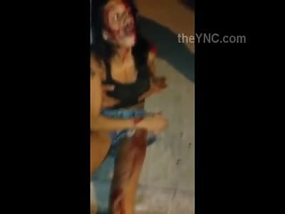 Woman Bloody and in Shock after Boyfriend Killed in Motorcycle Accident ... Who Keeps Grabbing her Tits?