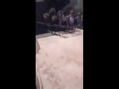 Horrific Ending to Man..His Leg Ripped Completely Off