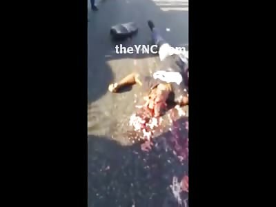 Messy Brains All Over the Road and the First on Scene 