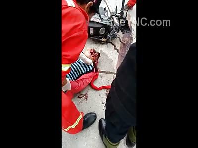 Skull Exploded Brains Everywhere