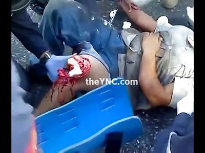 Wide Open Knee Man is in a PAIN 