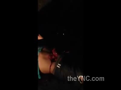 Mans Guts Still Moving and Working Outside his Body after Accident